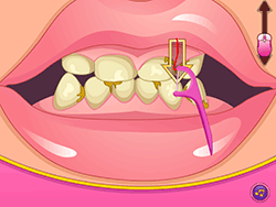 Jogue Bad Teeth Makeover Agora