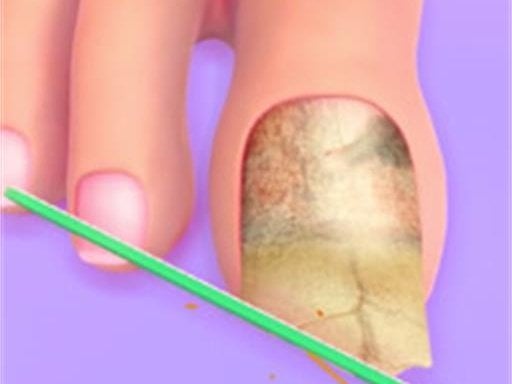 Doctor of your Foot - Free Games for Arcade Game