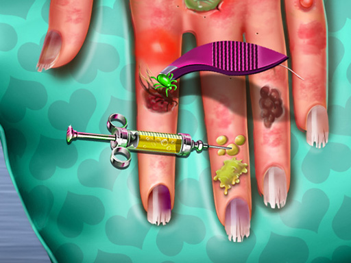 Hand Skin Doctor Games